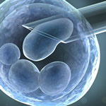 Fécondation in vitro (FIV)